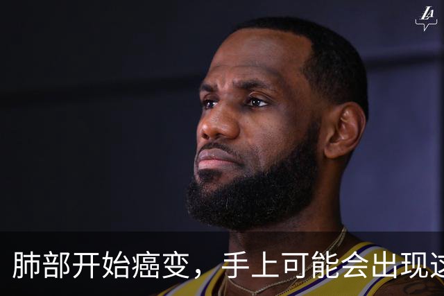 肺部开始癌变，手上可能会出现这些标志！40岁以上的人要重视了